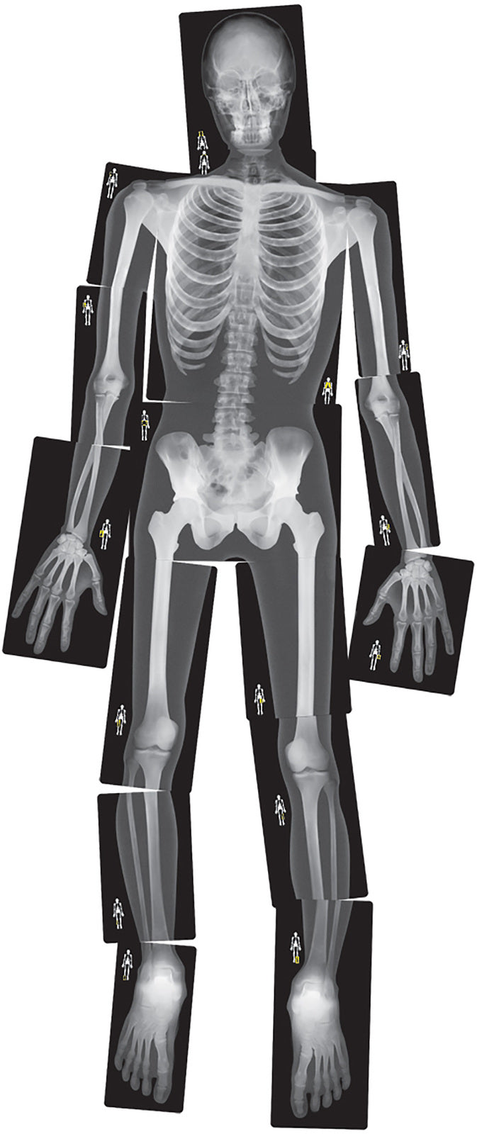 True To Life Human X-Rays - 18pcs